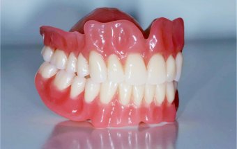 Diş protezlərinin allergik təsirləri