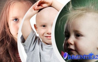Azyaşlı uşaqlarda saçın hissəvi və ya seyrək halda tökülməsi