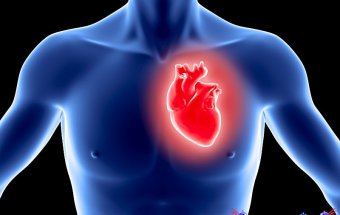 Miokard infarktının tromboembolik ağırlaşması