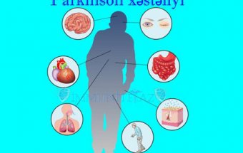 Parkinson xəstəliyi