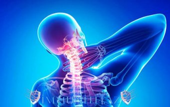 Onurğa osteoxondrozunun nevroloji fəsadları