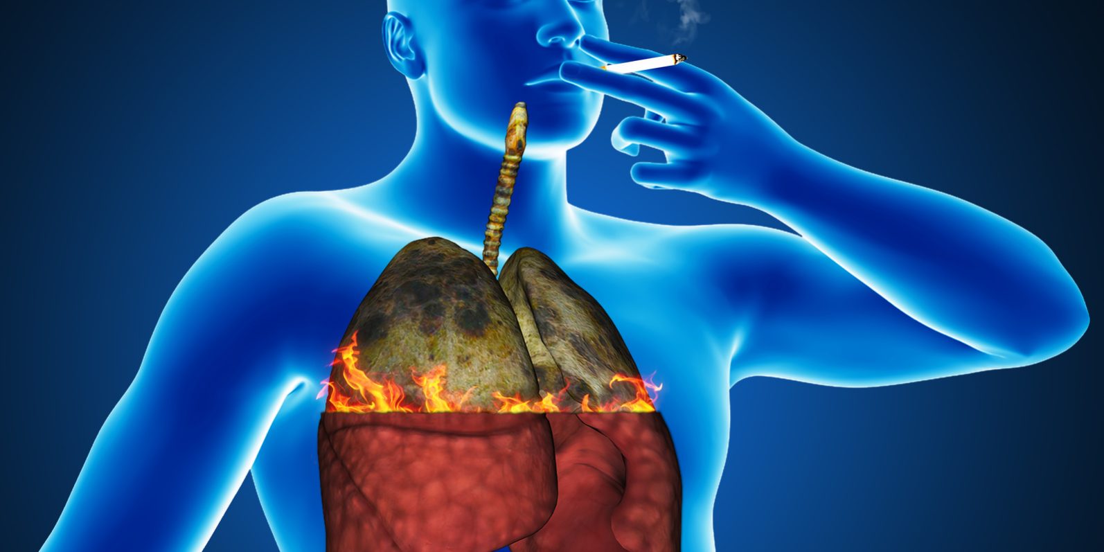 Пассивные болезни. Здоровый организм человека. Органы дыхания при курении. Лёгкие пассивного курильщика.