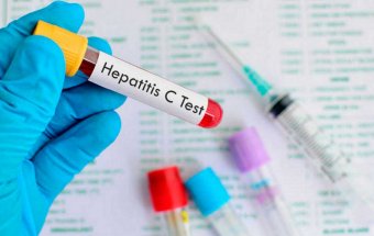 Hepatit C-nin zamanında düzgün müalicəsi